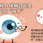 眼睛里的&ldquo;血管地图&rdquo;，50岁后必看的健康密钥